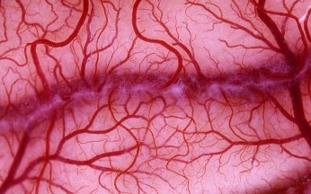 blood_vessels_1.jpg