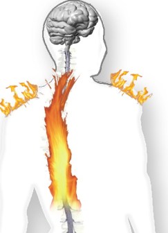 spinal-cord-injury-pain